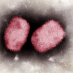 Aktuelle Information: „Affenpocken“/MPX